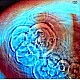 Pink Floyd - Meddle Plak LP